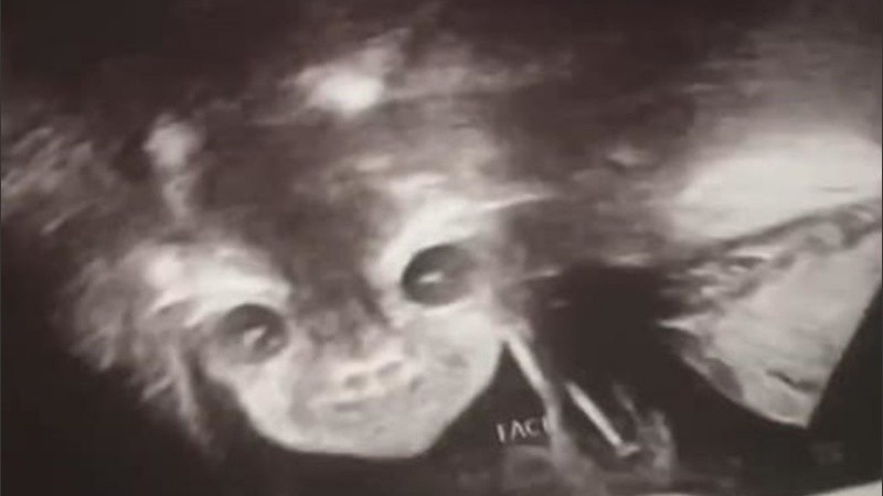 La beba se encuentra en perfecto estado de salud.