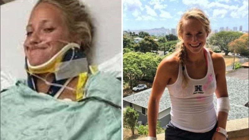 La joven sobrevivió y ahora es una jugadora profesional de voleibol en Estados Unidos.