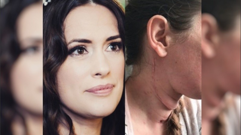 Actualmente, Rebecca Patterson recibe tratamiento psicológico y evoluciona bien.