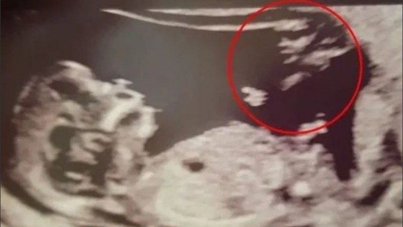 La joven tomó el hecho como una buena señal.