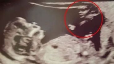 La joven tomó el hecho como una buena señal.