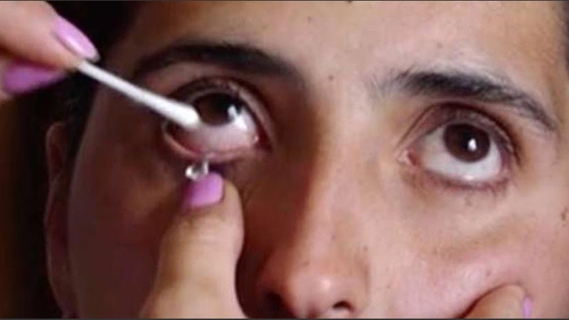 Los oftalmólogos no pudieron explicar el fenómeno.