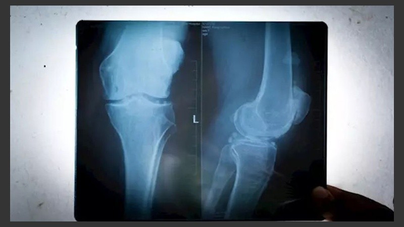 De 1918 a 2018 se triplicó el número de rodillas humanas que lucían fabelas.