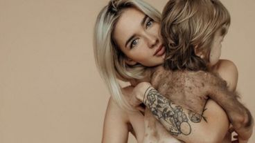 Su padecimiento no es sólo estético, sino que estos grandes lunares incrementan la posibilidad de que sufra cáncer de piel.