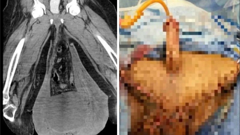 Luego de cuatro semanas, los médicos anunciaron que se estaba curando con éxito.