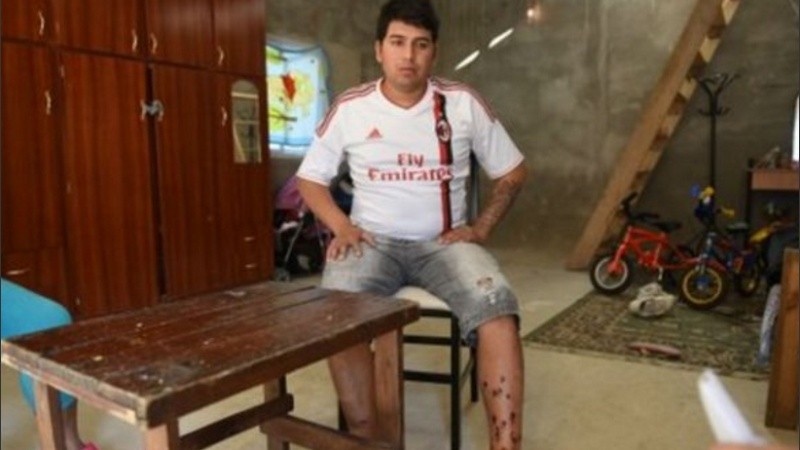 Ema Pimpi tenía 28 años. 