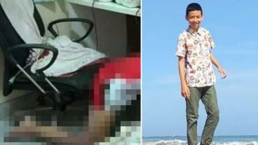 El adolescente murió de un derrame cerebral.