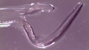 Es el segundo caso en poco tiempo seg{un especialistas.