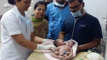 Este tipo de malformación ocurrió en menos de un millón de nacimientos.