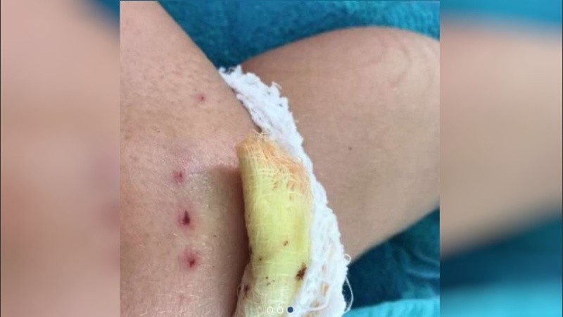 La niña sufrió mordiscos, cortes y hematomas.