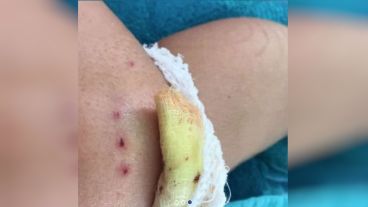 La niña sufrió mordiscos, cortes y hematomas.