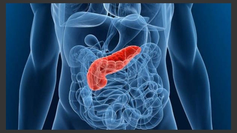 El cáncer de páncreas es uno de los más agresivos.
