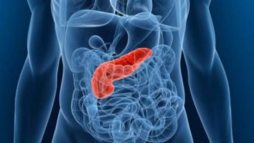 El cáncer de páncreas es uno de los más agresivos.