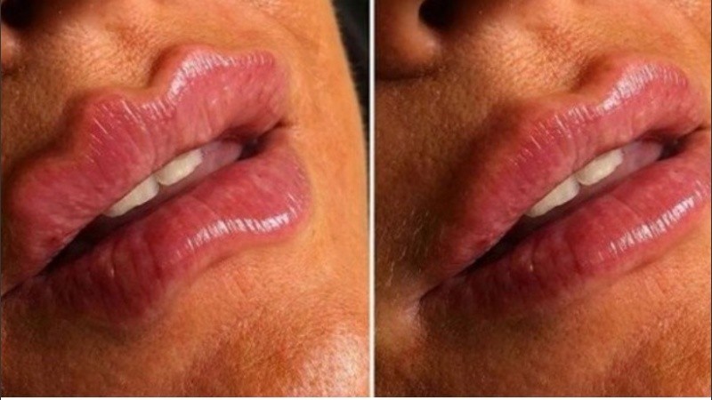 La tendencia nació en Rusia pero ya la piden en varias partes del mundo.