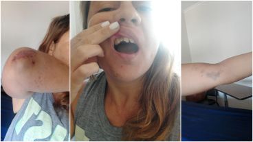 Está internada en un centro de salud privado de San Juan y Francia.