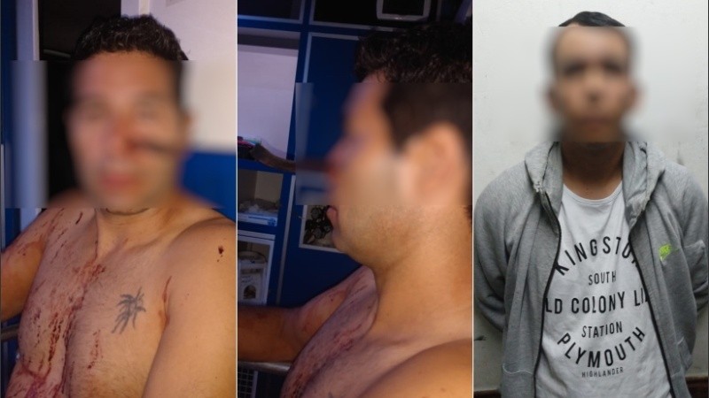 El hombre atacado con un cuchillo y el agresor, que fue detenido. 