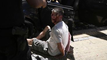 Así le quedó el rostro al hombre que arrojó la bomba molotov.