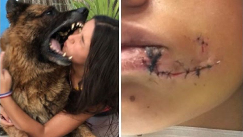 La joven se recupera tras las mordeduras.