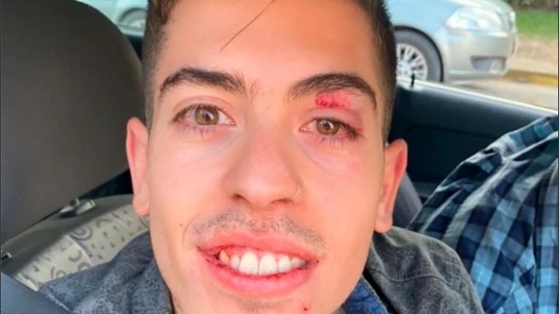 Matías Leloutre, un chico de 24 años, quien aparece en un video en el suelo, cubriéndose la cabeza mientras lo patean.