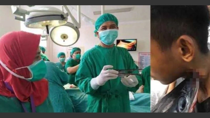  El joven que ya está fuera de peligro.