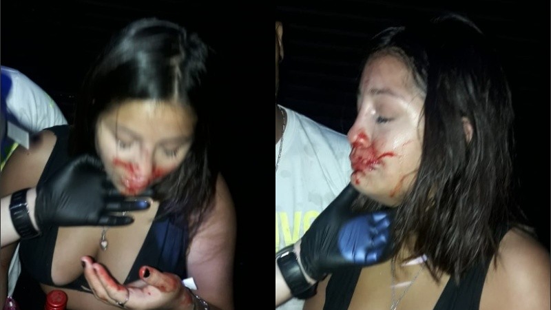 Así quedó el rostro de Sofía tras la paliza que recibió. 