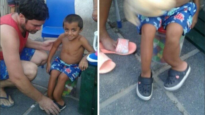 Ezequiel padece osteogénesis imperfecta, una operación le cambiaría la vida.