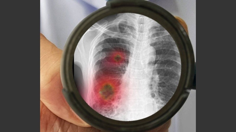 El coronavirus produce una enfermedad semejante a la gripe, incluso su modo de trasmisión.