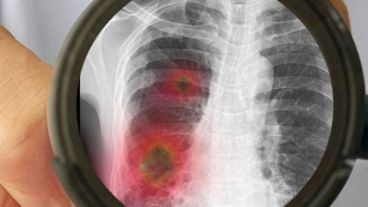 El coronavirus produce una enfermedad semejante a la gripe, incluso su modo de trasmisión.