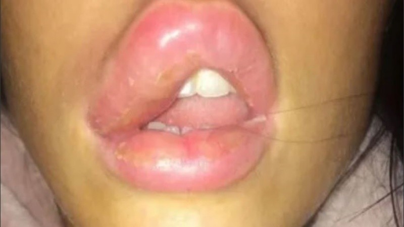 La joven tuvo que acudir al hospital porque ne el centro de salud no le dieron respuesta.