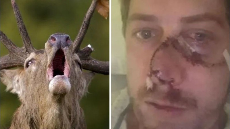 El hombre se recupera de las lesiones.