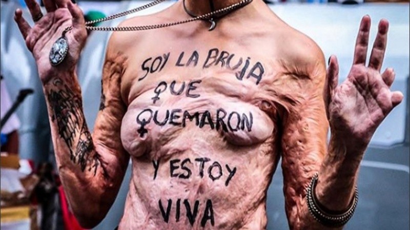 Una fotografía que conmueve e interpela. 