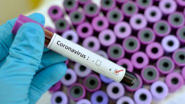 Test de coronavirus positivo.