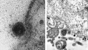 Se ve como el virus comienza a tomar contacto e infectar a la célula.