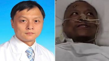 El antes y el después del Dr. Yi Fan.
