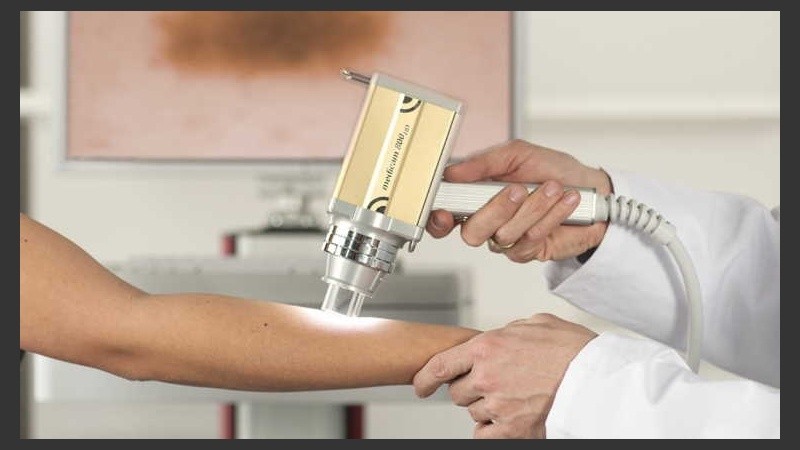 Este método representa la estrategia más confiable y eficiente en la detección precoz del melanoma.