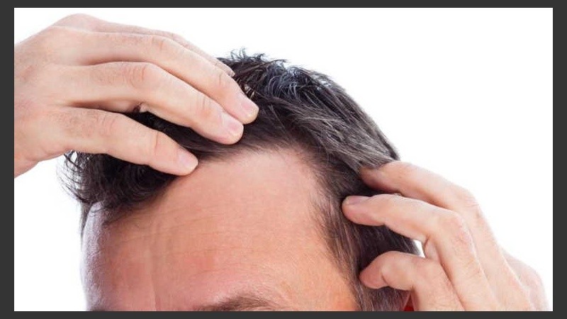 Afecta aproximadamente al 50 por ciento de todos los hombres y casi a tantas mujeres mayores de 50 años.