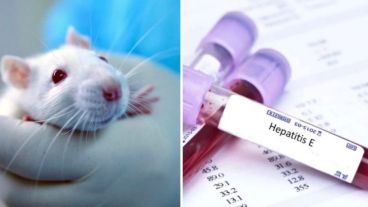 La cepa de hepatitis transmitida por ratas plantea un nuevo misterio.