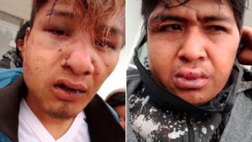 Los rostros de las víctimas, marcados por los golpes.