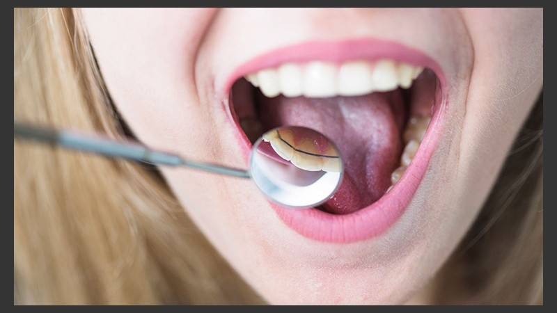 Las llagas suelen desaparecer solas, pero se puede acelerar el proceso.