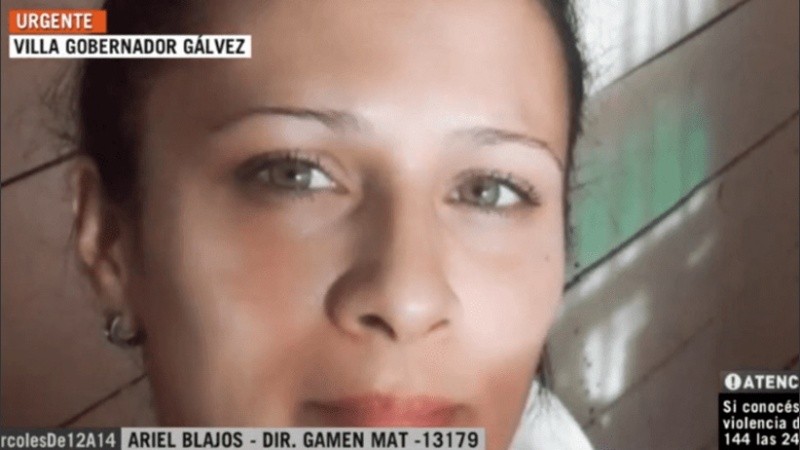 Érica sufrió quemaduras de gravedad en el 70 por ciento de su cuerpo. 