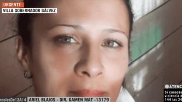 Érica sufrió quemaduras de gravedad en el 70 por ciento de su cuerpo.