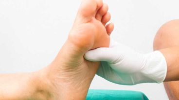 El pie diabético puede traer muchos inconvenientes; en primer lugar, es el talón de Aquiles del diabético ya que puede infectarse.