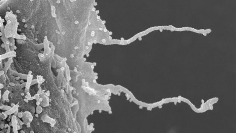 Los tentáculos se extienden desde una célula infectada por coronavirus a una sana.