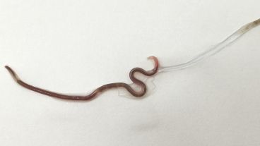 Este tipo de gusano infecta el tracto digestivo.