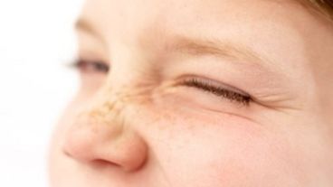 Uno de los tics es guiñar los ojos involuntariamente.