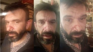 Giacometto compartió fotos de su estado en las redes.