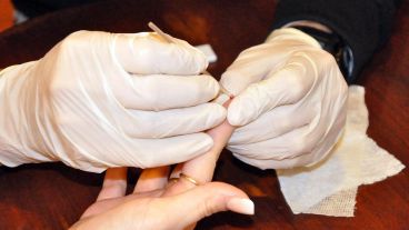 El procedimiento es voluntario y anónimo.