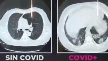 Las imágenes del spot de la Asociación Médica.