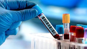 Los estudios serológicos son cada vez más solicitados.