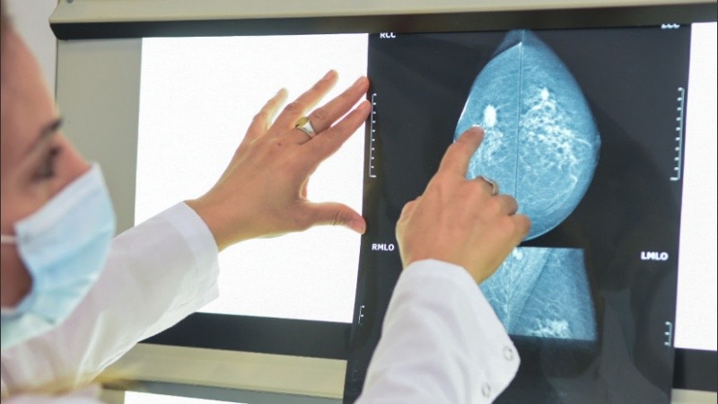 En el Centenario se hicieron 70% menos mamografías que el año pasado.
